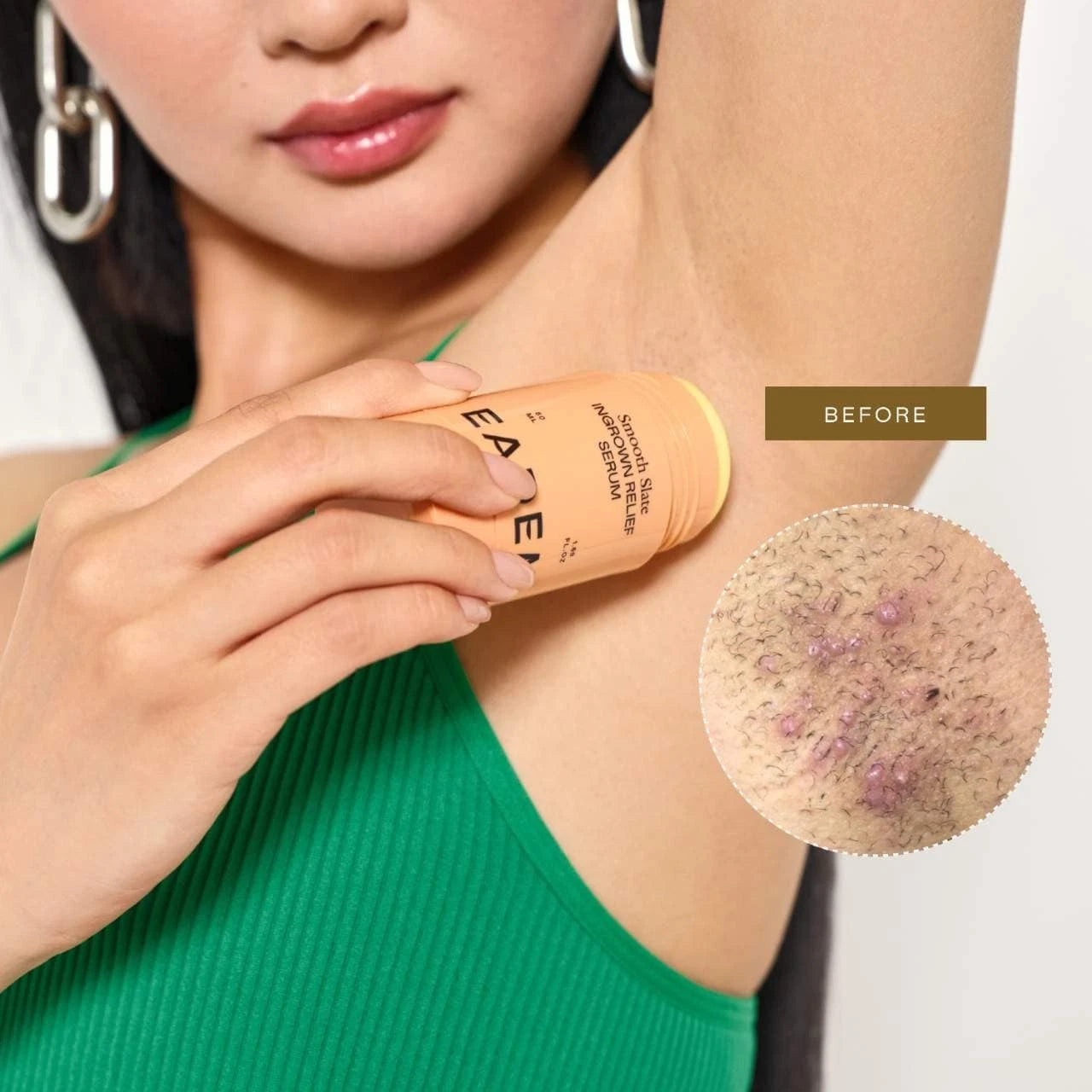 EADEM Smooth Slate Ingrown Relief Serum